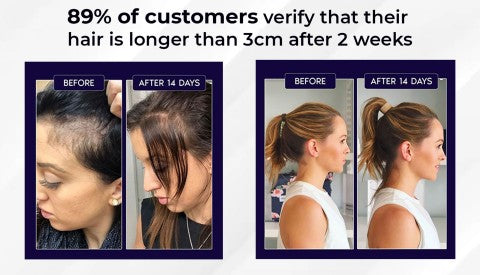 šæ Odeiun⢠Natural Hair Regrowth Spray ā Naturally regrow fuller hair and restore your confidence