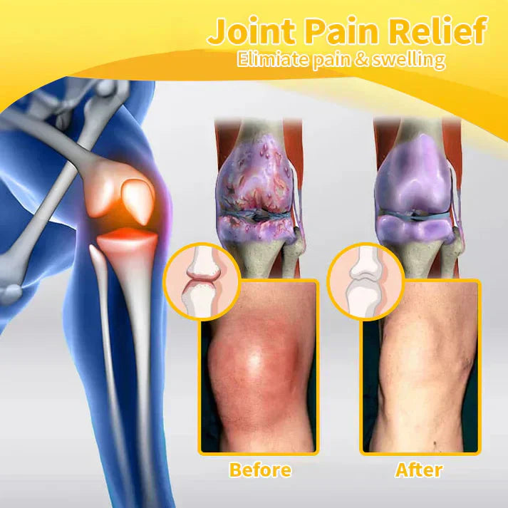 š ODEIUN⢠Magnesium & Bee Venom Joint Spray | Relieve Stiffness & Pain in 4 Weeks ā No Rebound, Just Results šŖ