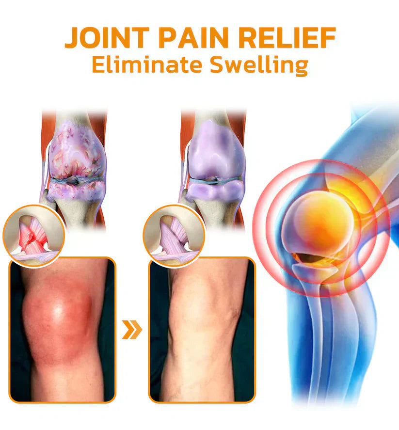 š ODEIUN⢠Magnesium & Bee Venom Joint Spray | Relieve Stiffness & Pain in 4 Weeks ā No Rebound, Just Results šŖ