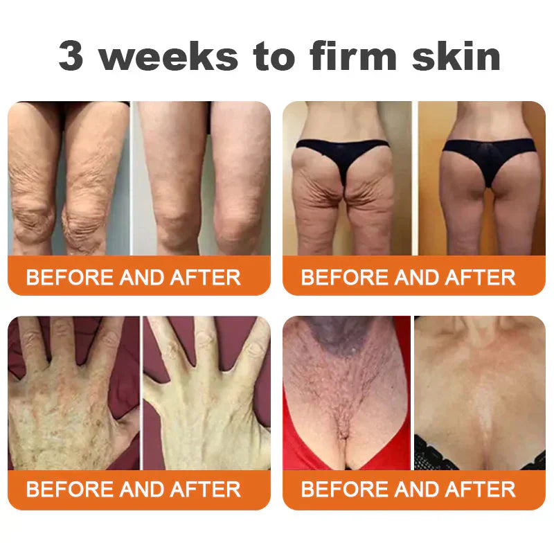 ⚡🔥Limited Time Only: Get 50% Off Now! 🎁 Odeiun™ Botox Bee Venom Firming Serum Stick