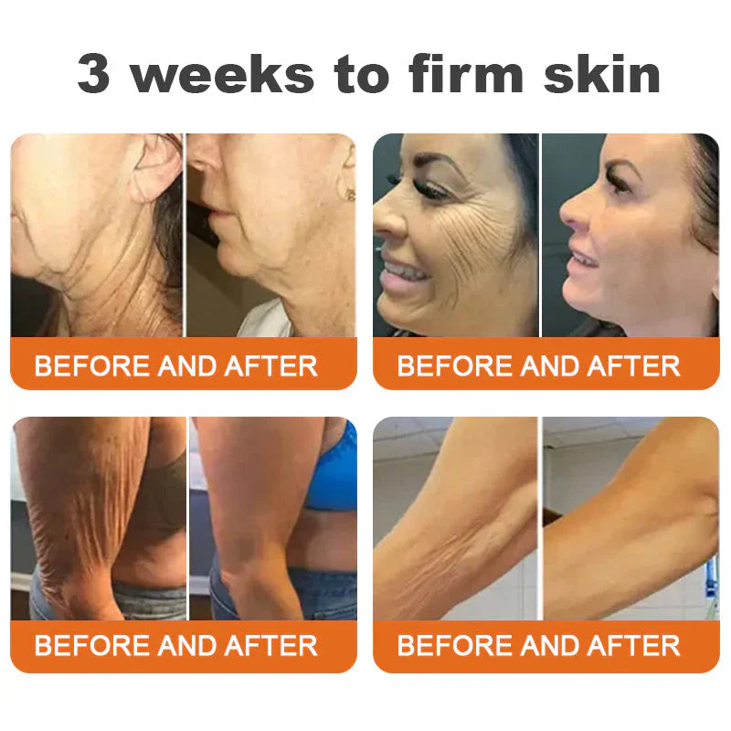 ⚡🔥Limited Time Only: Get 50% Off Now! 🎁 Odeiun™ Botox Bee Venom Firming Serum Stick