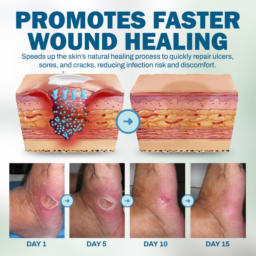NEGUSY™ Skincare Designed for Diabetic Patients🌟