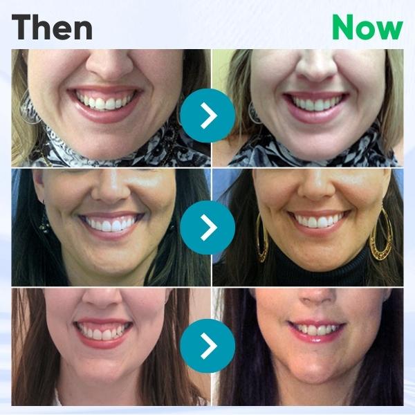 ODEIUN™ Gum Therapy Gel – Restore Receding Gums Naturally