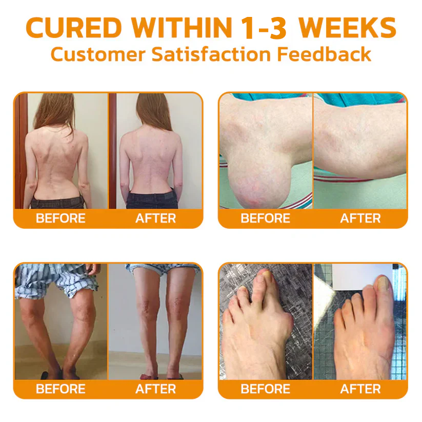 š ODEIUN⢠Magnesium & Bee Venom Joint Spray | Relieve Stiffness & Pain in 4 Weeks ā No Rebound, Just Results šŖ