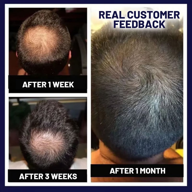 šæ Odeiun⢠Natural Hair Regrowth Spray ā Naturally regrow fuller hair and restore your confidence