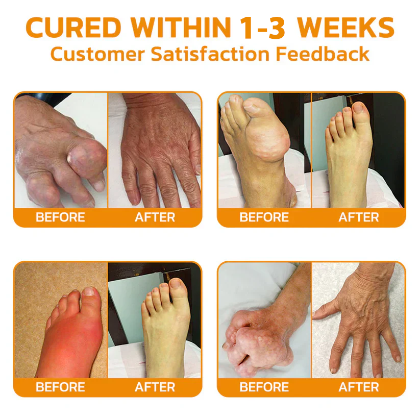 š ODEIUN⢠Magnesium & Bee Venom Joint Spray | Relieve Stiffness & Pain in 4 Weeks ā No Rebound, Just Results šŖ