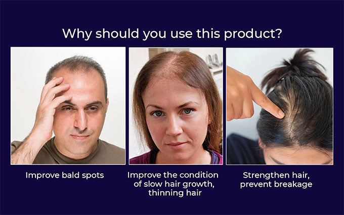 šæ Odeiun⢠Natural Hair Regrowth Spray ā Naturally regrow fuller hair and restore your confidence