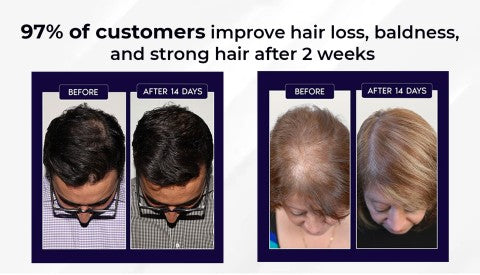 šæ Odeiun⢠Natural Hair Regrowth Spray ā Naturally regrow fuller hair and restore your confidence