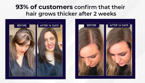 šæ Odeiun⢠Natural Hair Regrowth Spray ā Naturally regrow fuller hair and restore your confidence
