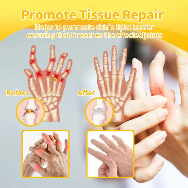 š ODEIUN⢠Magnesium & Bee Venom Joint Spray | Relieve Stiffness & Pain in 4 Weeks ā No Rebound, Just Results šŖ