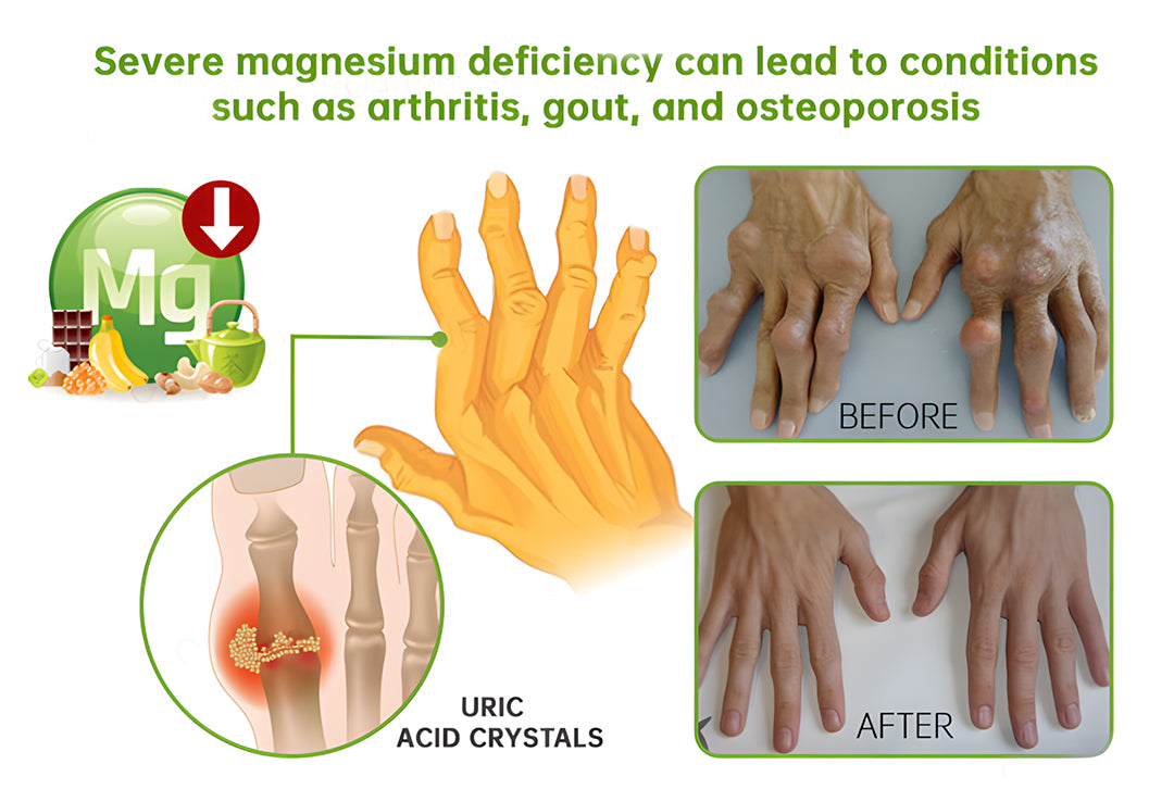 đNEGUSY⢠Magnesium & Peppermint Arthritis & Bone Healing Cream â Fast Pain Relief & Joint Support
