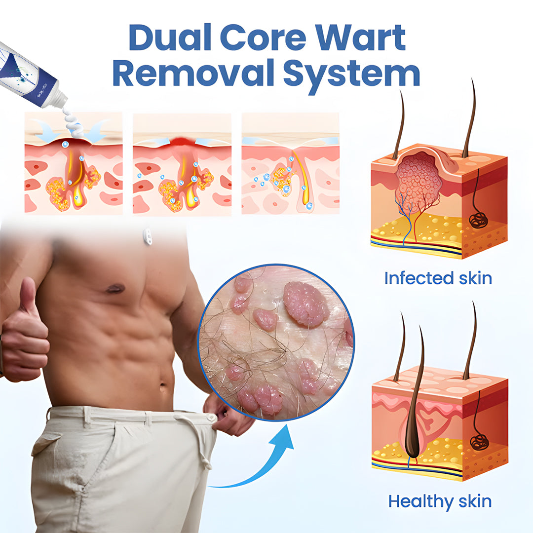 đż ODEIUN⢠WartClear Treatment Cream â Deep Penetration, Gentle Removal of Genital Warts