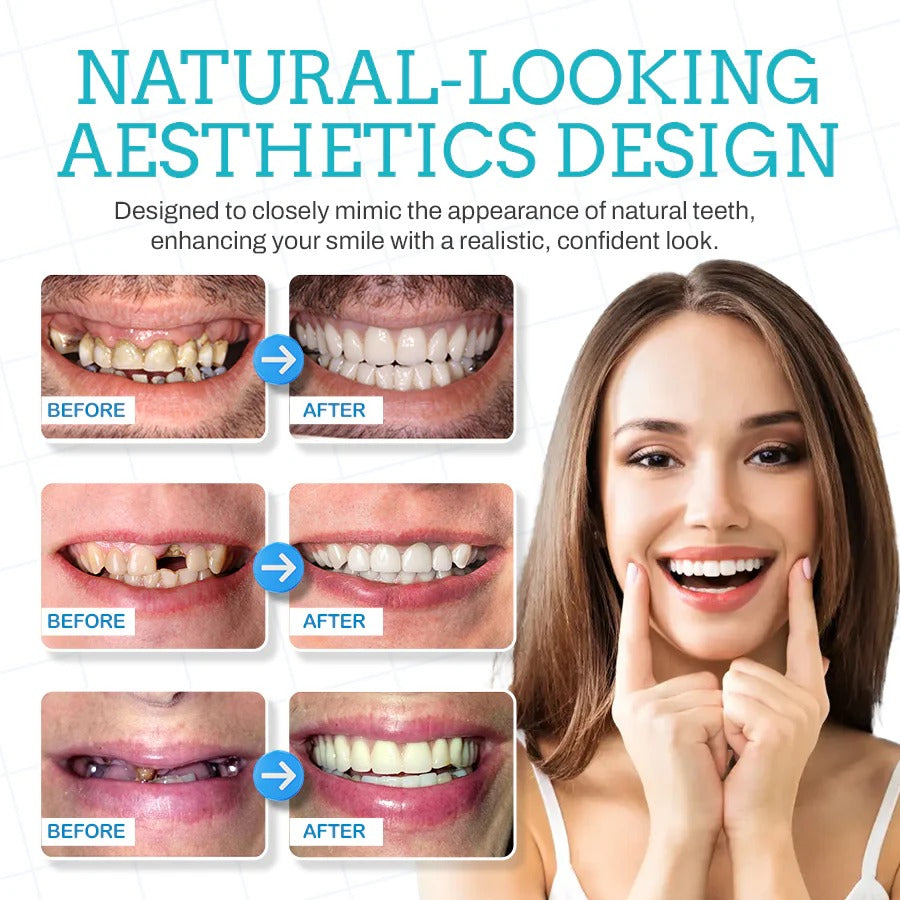Seurico™ Adjustable Snap-On Dentures 🔥 LAST DAY SALE 65% OFF