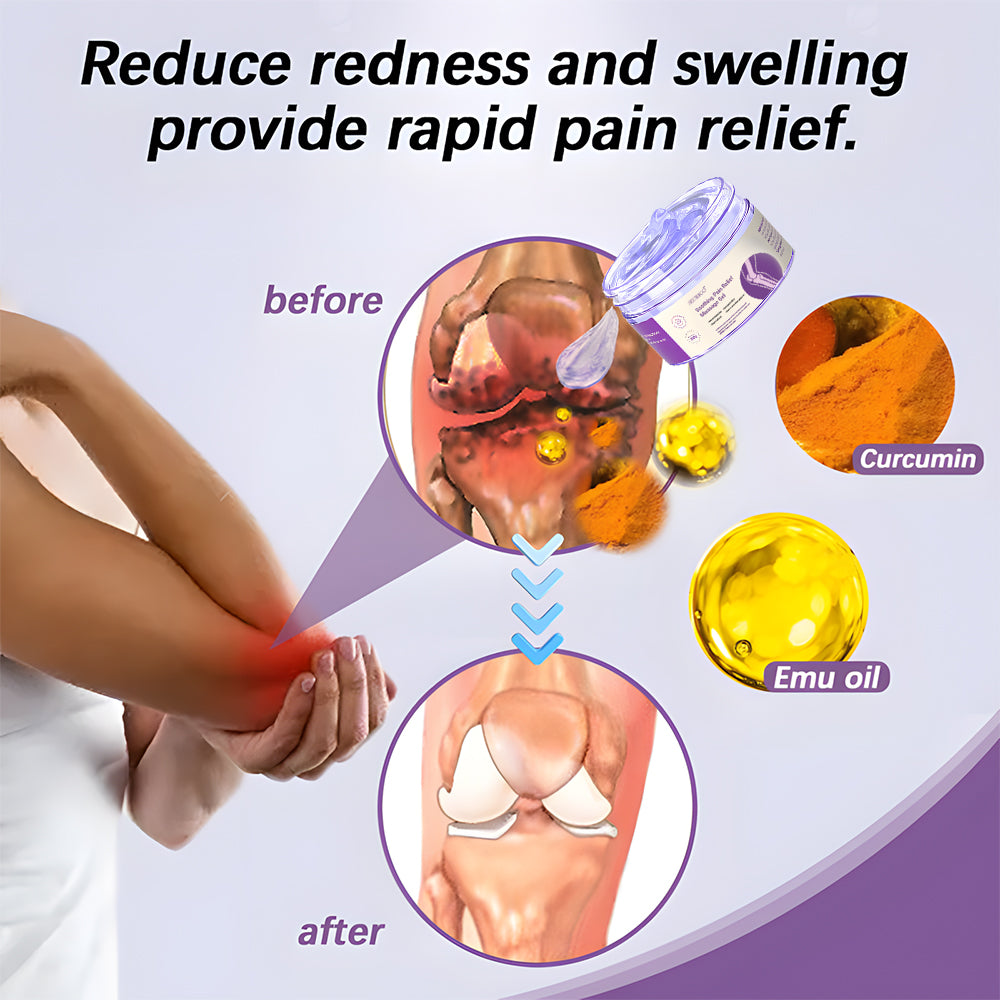 Seurico™ Joint Rescue Gel – Turmeric & Emu Oil Formula for 7-Day Pain Relief