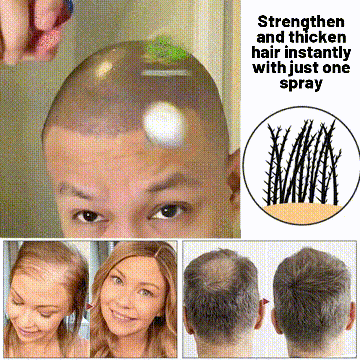 šæ Odeiun⢠Natural Hair Regrowth Spray ā Naturally regrow fuller hair and restore your confidence