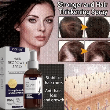 šæ Odeiun⢠Natural Hair Regrowth Spray ā Naturally regrow fuller hair and restore your confidence