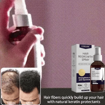 šæ Odeiun⢠Natural Hair Regrowth Spray ā Naturally regrow fuller hair and restore your confidence
