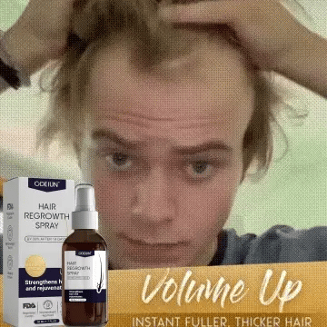 šæ Odeiun⢠Natural Hair Regrowth Spray ā Naturally regrow fuller hair and restore your confidence
