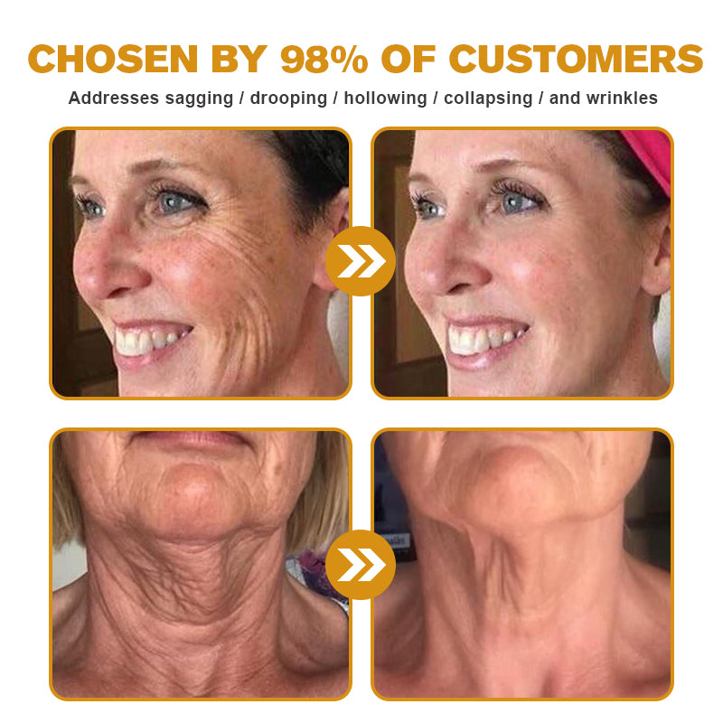 Seurico⢠Botox Bee Venom Wrinkle Removal Cream- LAST DAY 70% OFF