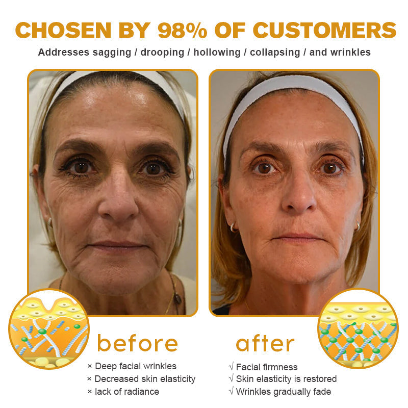 Seurico⢠Botox Bee Venom Wrinkle Removal Cream- LAST DAY 70% OFF
