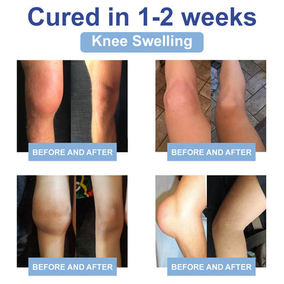 ✅ Mayo Clinic Approved: Seurico™ Magnesium Pain & Bone Healing Cream – Fast Relief for Neuropathy, Arthritis, Muscle Spasms & Injuries