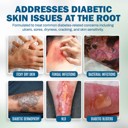 NEGUSY™ Skincare Designed for Diabetic Patients🌟