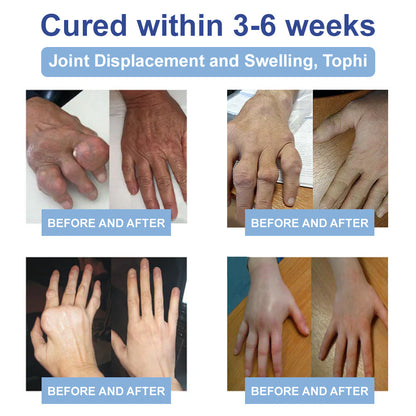 ✅ Mayo Clinic Approved: Seurico™ Magnesium Pain & Bone Healing Cream – Fast Relief for Neuropathy, Arthritis, Muscle Spasms & Injuries