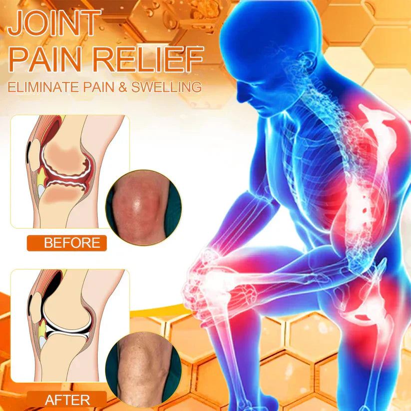 🐝 ODEIUN™ Magnesium & Bee Venom Joint Spray | Relieve Stiffness & Pain in 4 Weeks — No Rebound, Just Results 💪