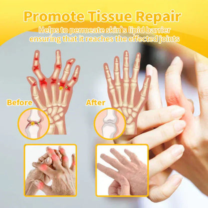 🐝 ODEIUN™ Magnesium & Bee Venom Joint Spray | Relieve Stiffness & Pain in 4 Weeks — No Rebound, Just Results 💪
