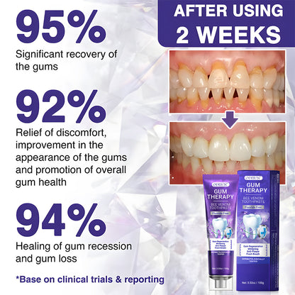 ODEIUN™ VioCore Bee Venom Dental Treatment Toothpaste