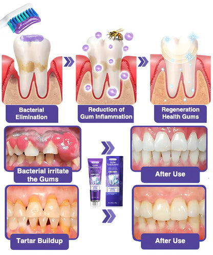 ODEIUN™ VioCore Bee Venom Dental Treatment Toothpaste