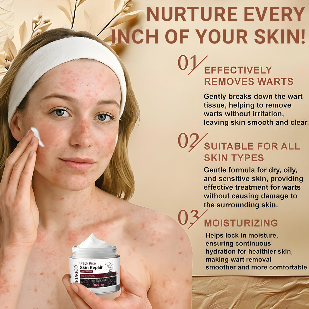 Seurico™ Black Rice Skin Repair Cream ⚕️ FDA Certified – Targets Warts, Psoriasis & Pigmentation