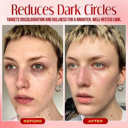 ✨ Seurico™ Instant Eye Bag Eraser: Visibly Lift & Smooth in Seconds