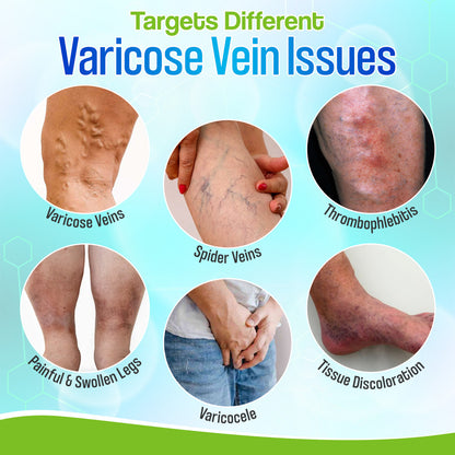 🎁 ODEIUN™ VeinGuard Herbal Spray – ✅ Clinically Proven to Erase Varicose Veins in Just 7 Days!