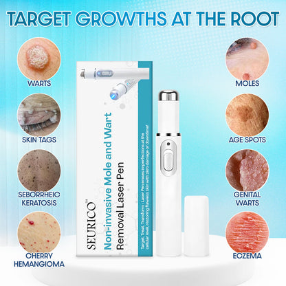 ✨Seurico™ Laser Pen - Non-invasive Mole and Wart Removal