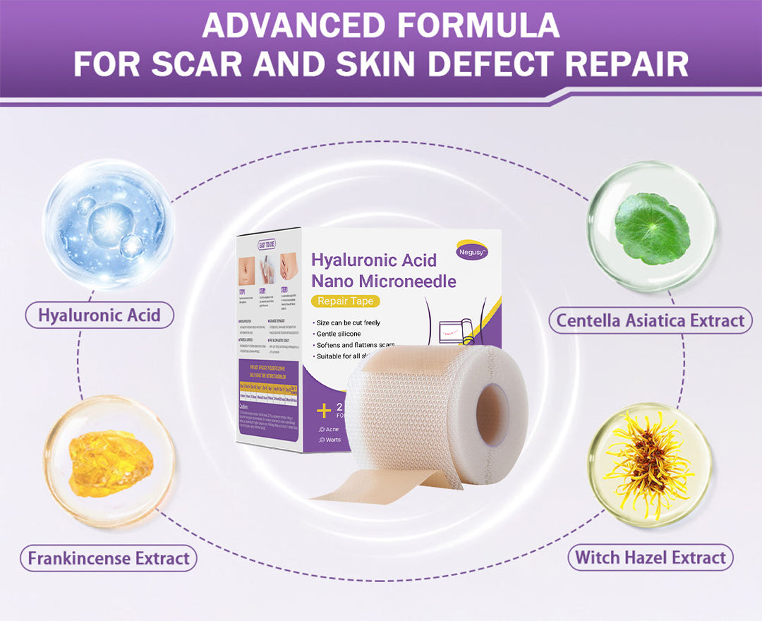 ✅Official Store |Negusy Hyaluronic Acid Nano Microneedle Repair Tape🗽🏥(Treatment of old and new scars, reduction of surgical scars, stretch marks, keloids, acne, burns, warts, dermatomes and varicose veins)