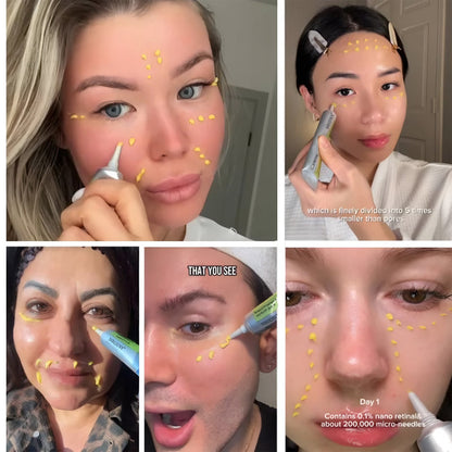 Negusy™ Vita-A Retinal Firming Complex: Advanced Skin Renewal for Wrinkle Smoothing and Pore Refinement