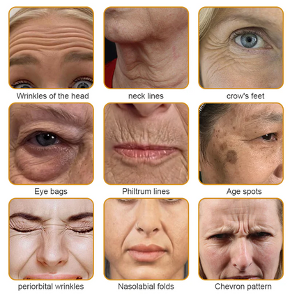 LBMLBM™ Botox Bee Venom Wrinkle Removal Cream – Look Younger in Days | 50% OFF Today Only ✅