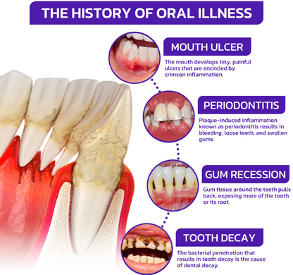 ODEIUN™ VioCore Bee Venom Dental Treatment Toothpaste